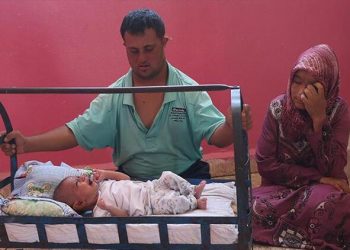 Suriye’de ‘mucize bebek’ yardım bekliyor